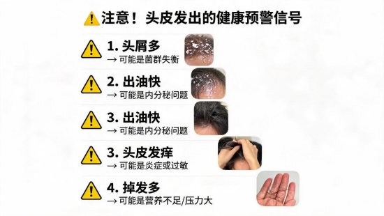 头皮发出的健康预警信号，你注意到了吗